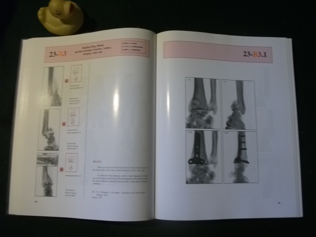 Atlas Of Internal Fixation: Fractures Of Long Bones by R. Orozco et al. Springer-Verlag, 2000 - Image 3
